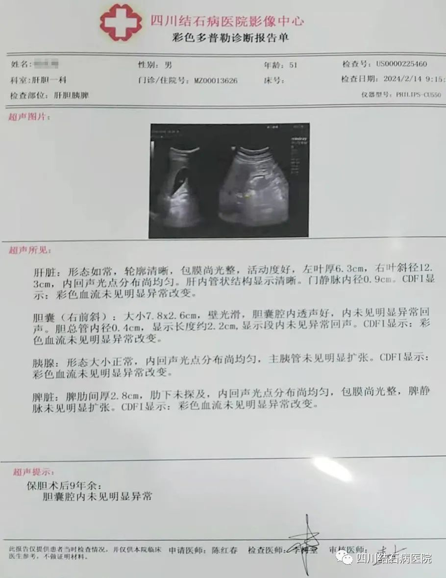 四川保胆案例分享：保胆9年患者，用亲身经历讲述术后生活！(图1)