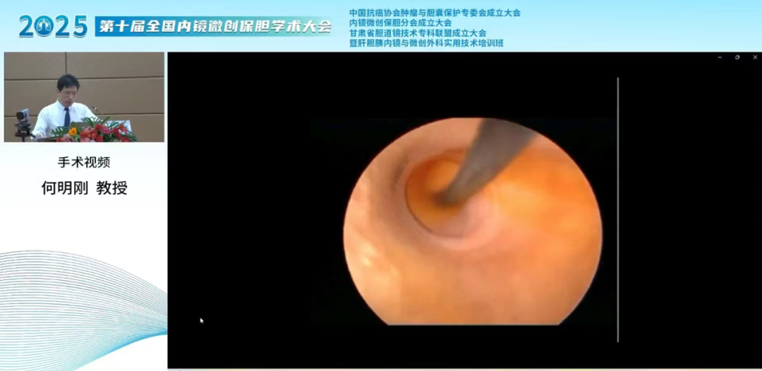 荣耀时刻：四川结石病医院何明刚主任荣膺全国保胆分会常委(图7)