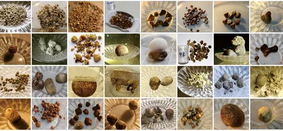 胆囊结石的“伪装术”有多高？这3大疼痛症状或许都是它的把戏！(图5)