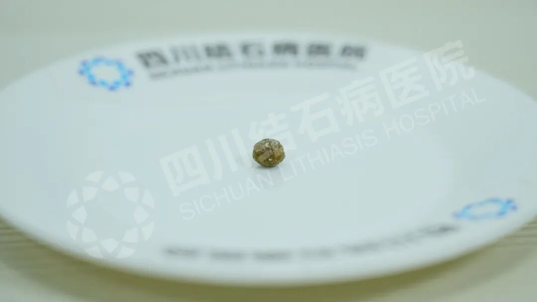 一面鲜红的锦旗 一段跨越雪域高原的保胆之旅【四川保胆取石医院】(图3) 一面鲜红的锦旗 一段跨越雪域高原的保胆之旅【四川保胆取石医院】(图3)