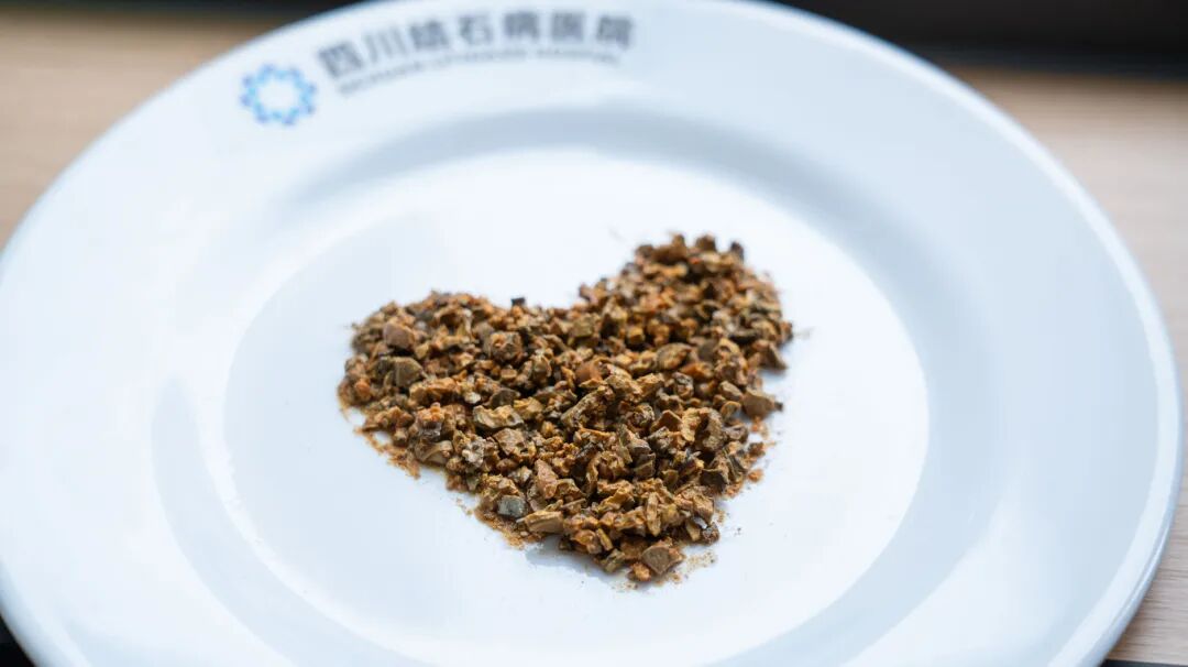 2025年度|四川结石病医院泌尿外科:锚定精准医疗,深耕亚专业建设(图5) 2025年度|四川结石病医院泌尿外科:锚定精准医疗,深耕亚专业建设(图5)