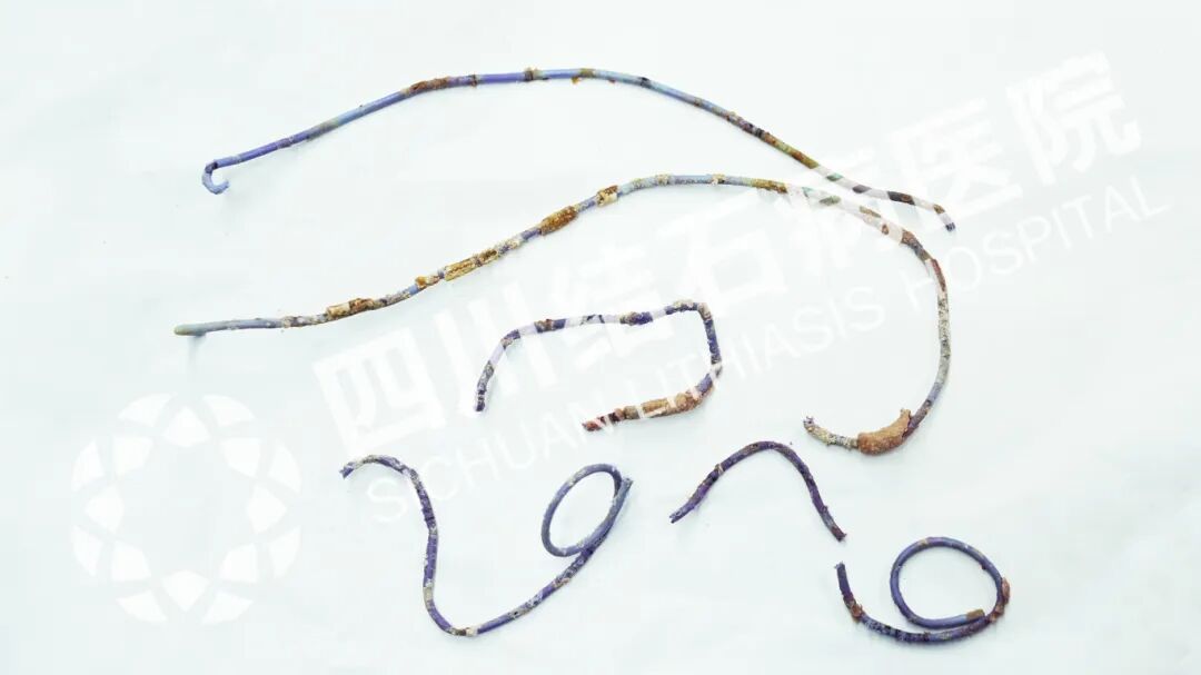 2025年度|四川结石病医院泌尿外科:锚定精准医疗,深耕亚专业建设(图7) 2025年度|四川结石病医院泌尿外科:锚定精准医疗,深耕亚专业建设(图7)